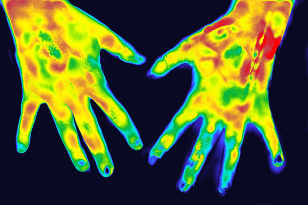 istock Thermography in medicine 1246944838