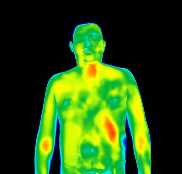 istock Human infrared thermography 1246946834