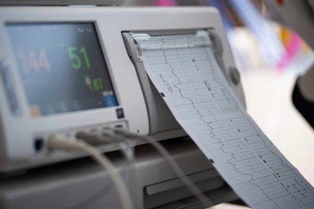 istock Heart rate monitor 1247050461