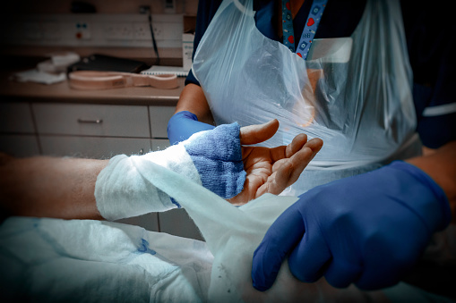A nurse unwrapping the bandage and padded lining from a senior man’s hand before removing the surgical stitches from the healing incision. The man had recently received surgery for carpal tunnel syndrome (CTS), an unpleasant condition in which pressure on the nerve in the wrist causes numbness, pain and tingling in the hand and fingers. Carpal tunnel release surgery involves dividing a ligament in the wrist to relieve the pressure.