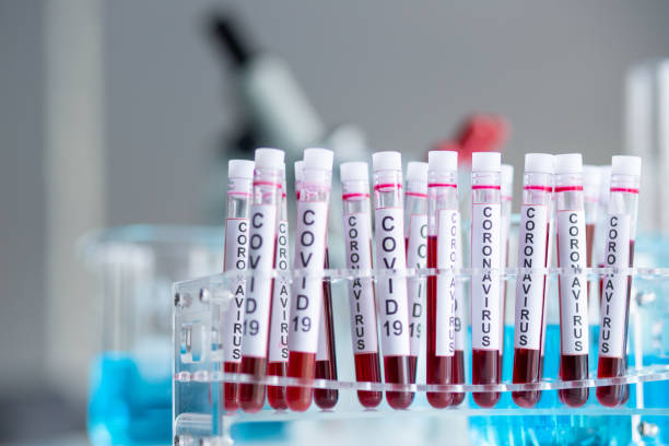 istock Bio Chemistry lab with blood test tubes 1247642709
