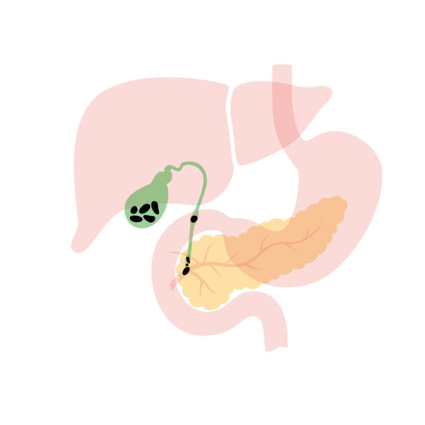 膵臓と胆嚢 - leaf gall点のイラスト素材／クリップアート素材／マンガ素材／アイコン素材