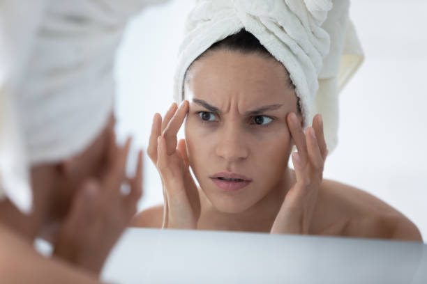 Close up unhappy woman checking skin, looking in mirror Close up unhappy woman wearing white bath towel checking skin after shower, looking in mirror, worried about mimic wrinkle or acne, touching face skin, facial cosmetology, treatment, skincare concept forehead photos stock pictures, royalty-free photos & images