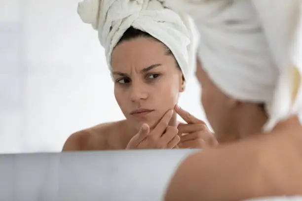 Close up unhappy young woman wearing white bath towel on head squeezing pimple on cheek, standing in bathroom, dissatisfied girl checking face after shower, looking in mirror, skin problem