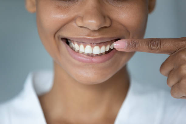 Close up African American woman pointing finger at healthy smile Close up African American young woman pointing finger at healthy toothy smile, straight white teeth, satisfied client customer recommending dental whitening service, oral hygiene and treatment teeth photos stock pictures, royalty-free photos & images
