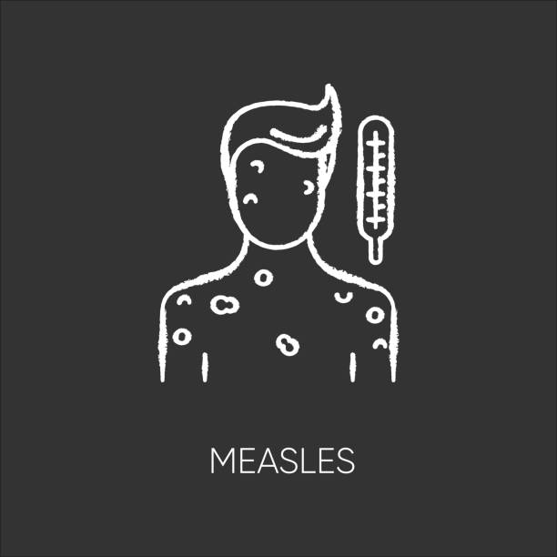 Measles chalk white icon on black background. Pandemic viral infection, contagious rubella virus, chickenpox. Infected person with rash and fever isolated vector chalkboard illustration Measles chalk white icon on black background. Pandemic viral infection, contagious rubella virus, chickenpox. Infected person with rash and fever isolated vector chalkboard illustration measles illustrations stock illustrations