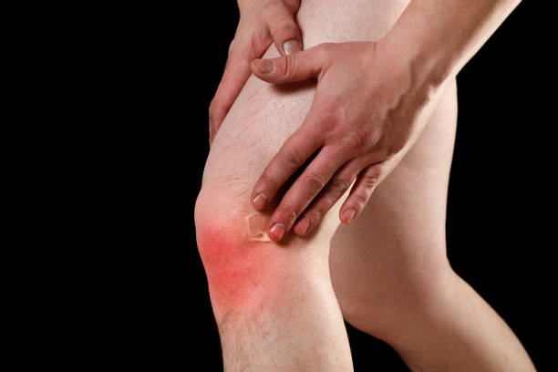 istock rubbing medicated ointment into the affected knee 1248202426