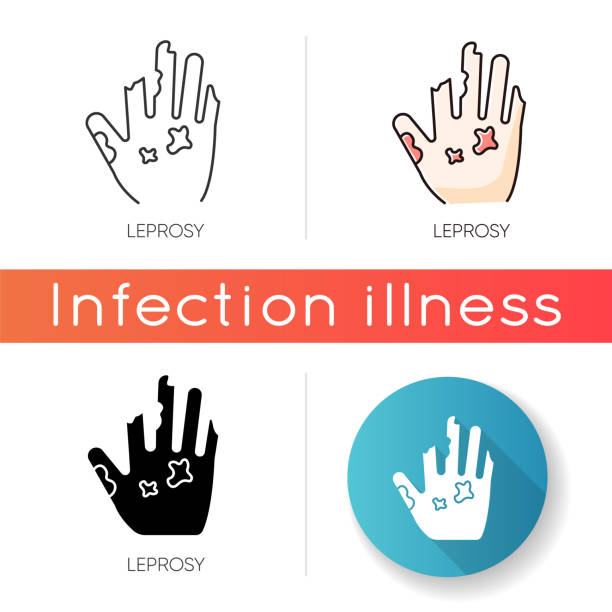 Leprosy icon. Linear black and RGB color styles. Dangerous bacterial disease, contagious illness. Nerve damaging sickness. Healthcare and medicine. Disfigured human hand isolated vector illustrations Leprosy icon. Linear black and RGB color styles. Dangerous bacterial disease, contagious illness. Nerve damaging sickness. Healthcare and medicine. Disfigured human hand isolated vector illustrations leprosy stock illustrations