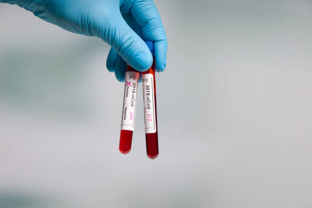 hand in blue gloves handling two blood test tubes after virus analysis with result markers in a medical lab Doctor's hand with medical glove and a test tube antibody test photos stock pictures, royalty-free photos & images
