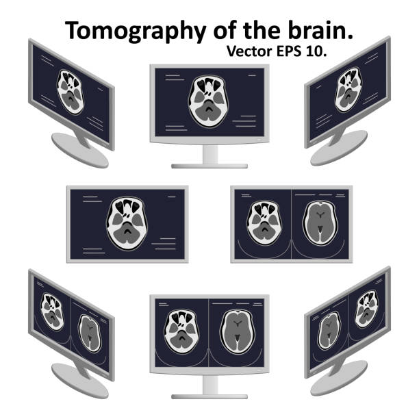 bildbanksillustrationer, clip art samt tecknat material och ikoner med uppsättning av tvärsnitt av hjärnan under magnetisk resonanstomografi på en datorskärm i isometrisk vy. några bilder på bilden av hjärnan. mrt / datortomografi. vektor eps10. - brain scan'