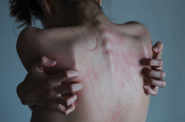 Scratches on a back Rear view - Female hand scratching her irritation back. Concept neurotic disorder, mental illness of self-harm. self harm photos stock pictures, royalty-free photos & images