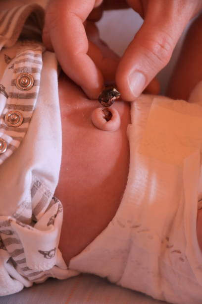 istock Dried and fallen umbilical stub remains 1248689517
