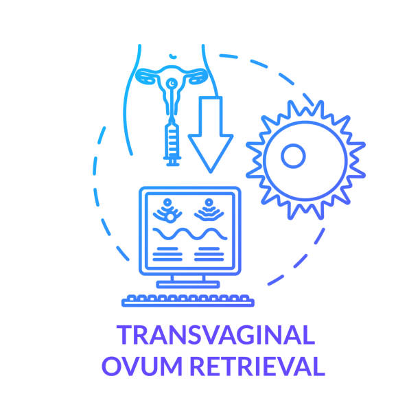 ilustrações, clipart, desenhos animados e ícones de ícone conceitual transvaginal ovum de recuperação azul. fertilização in vitro. operação vaginal. tecnologia reprodutiva ideia ilustração linha fina. desenho de cor rgb de contorno isolado do vetor - retrieval