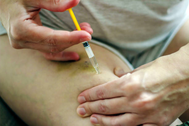 istock Female make insulin self injection in hip. 1248719525
