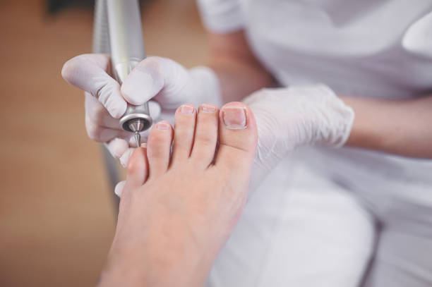 hardware medical pedicure with nail file drill apparatus. patient on pedicure treatment with pediatrician chiropodist. foot peeling treatment at spa with a special device. clinic of podiatry podology - podiatrist podiatry pedicure chiropodist imagens e fotografias de stock