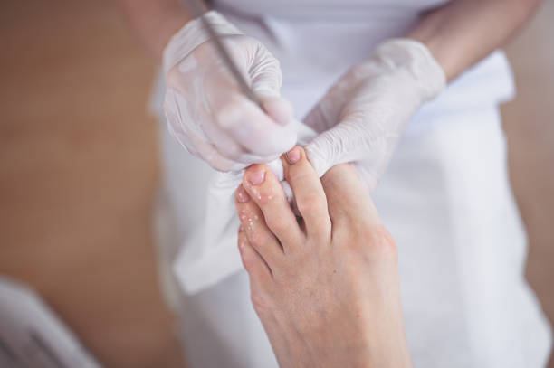 procédure médicale professionnelle de pédicure de près vers le haut utilisant l’instrument double d’ongle. podiatre de chiropodiste de visite de patient. traitement des pieds dans le salon spa. clinique de podiatrie. mains pédicuristes dans des ga - podiatrist podiatry pedicure chiropodist photos et images de collection