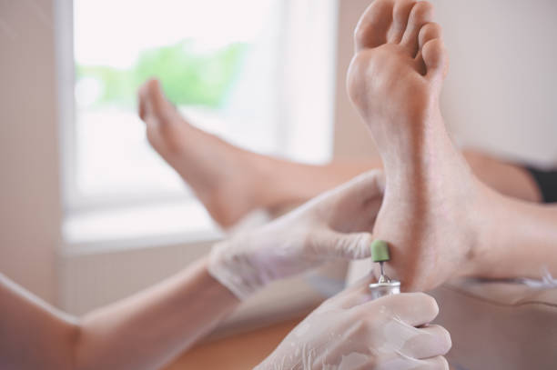 podiatrist che utilizza attrezzature di rettifica e fa lucidatura della procedura per la pedicure dei piedi. estetista podologia in guanti bianchi che puliscono la pelle delle gambe del cliente da callo e mais con strumento professionale. - pedicure human foot podiatrist moisturizer foto e immagini stock