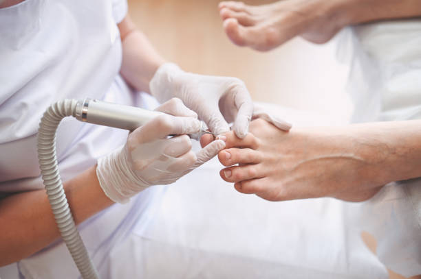 pédicure médicale de matériel avec l’appareil de perceuse de fichier d’ongle. patient sur le traitement de pédicure avec le chiropodiste de pédiatre. traitement d’épluchage de pied au spa avec un dispositif spécial. clinique de podologie podia - podiatrist podiatry pedicure chiropodist photos et images de collection