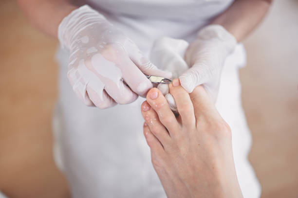 procedimento médico profissional de pedicure de perto usando instrumento de cortador de unhas. paciente visitando podólogo quiropodista. tratamento para pés no salão spa. clínica de podologia. mãos pedicuristas em luvas brancas. - podiatry human foot podiatrist surgery - fotografias e filmes do acervo