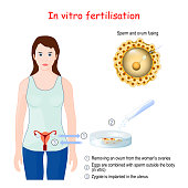 in-vitro-fertilisation.jpg?b=1&s=170x170&k=20&c=MXYJ3Jb1FMRTcYCs4VTg3M9vYOdasUGiYvabBL4_CTg=