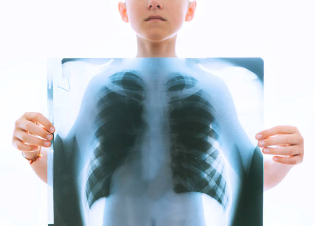junge teenager mit einer brust und lunge röntgenfilm-scan vor dem körper auf dem weißen hintergrund. medizinische diagnose und behandlung von atemwegserkrankungen konzeptbild. - illness x ray image chest x ray stock-fotos und bilder