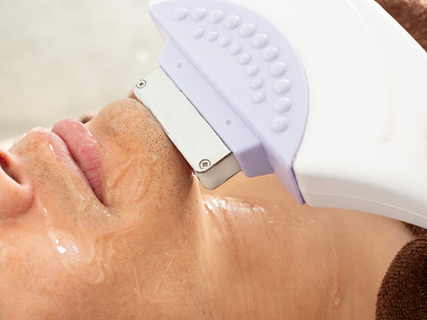 A man undergoing beard hair removal treatment on the jaw