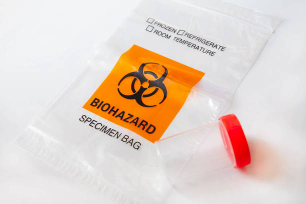 istock Lab test for diagnosis of coronavirus infection 1249219673