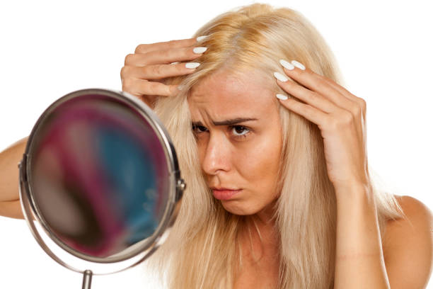 istock blonde woman looking her scalp 1249506405