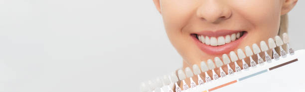 istock Teeth whitening process. Dental care 1249579181