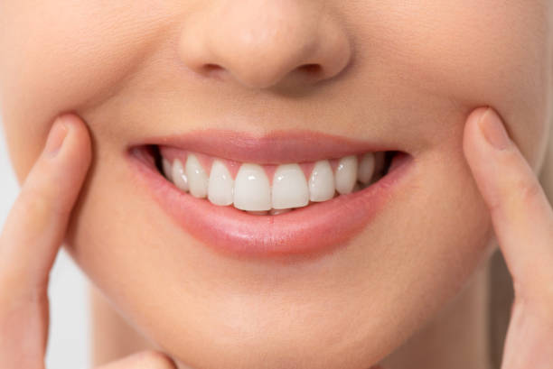 istock Teeth whitening, perfect smile 1249648369