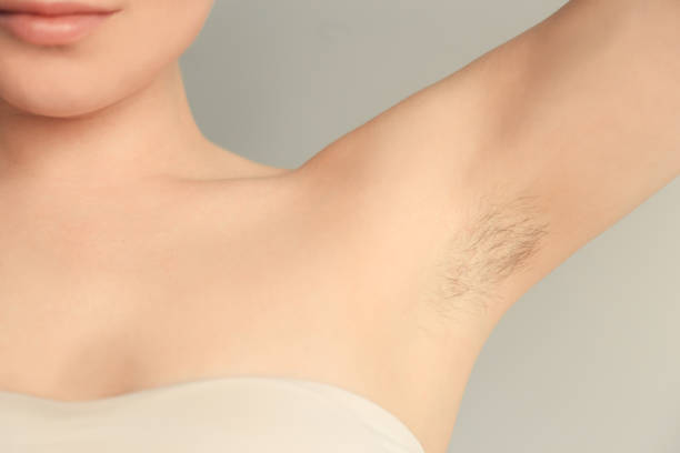 istock Woman's Underarm Hair Removal On Grey Background 1249874244