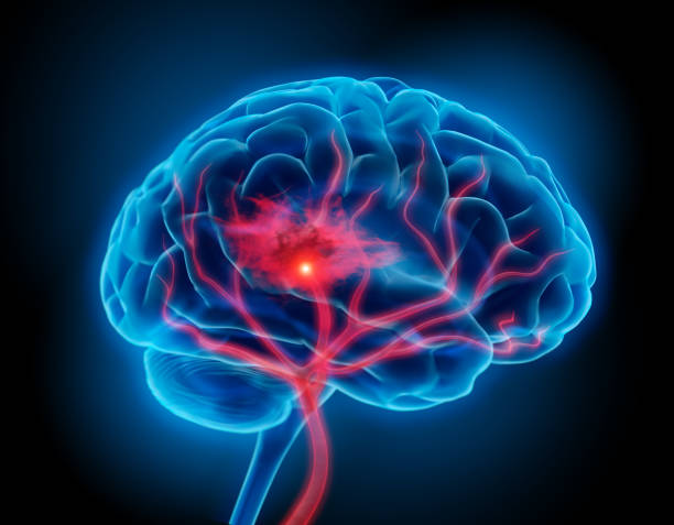 Brain Stroke Illustration of human brain with stroke symptom stroke illness photos stock pictures, royalty-free photos & images