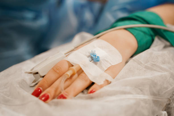 istock Anesthesia for surgery. Vasofix safely inserted into woman hand on plastic operation. 1250122972