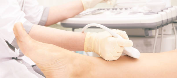 exame médico de ultrassom no joelho. escaneie o equipamento médico. diagnóstico de ultrassom. ferramenta de exame de tornozelo varicose - podiatry human foot podiatrist surgery - fotografias e filmes do acervo