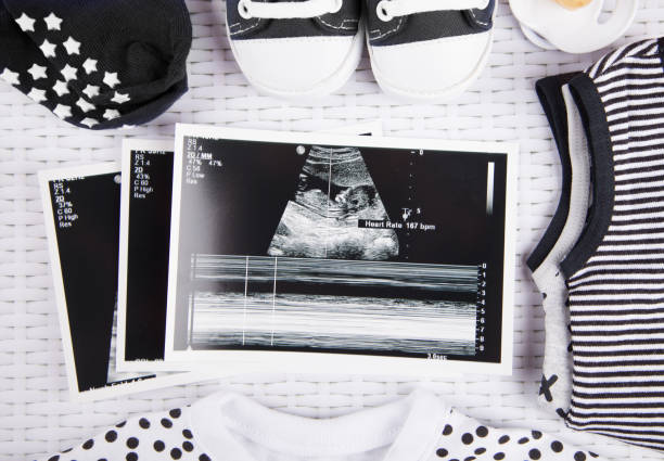 istock Pregnancy Test & Ultrasound Photo 1250161447
