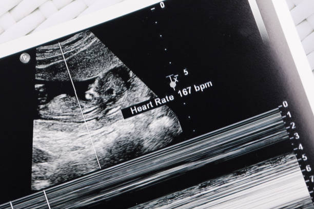 istock Pregnancy Test & Ultrasound Photo 1250161451
