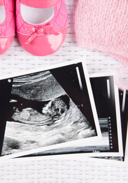 istock Ultrasound photo & pregnancy test 1250162101