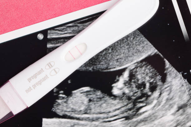 Pregnancy Joy, IVF, Finally Conceived stock photo