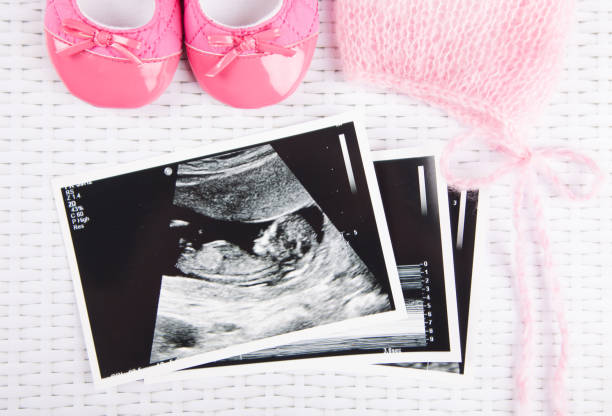istock Ultrasound photo & pregnancy test 1250162114