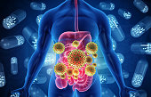 Human digestive system infected by virus and bacteria