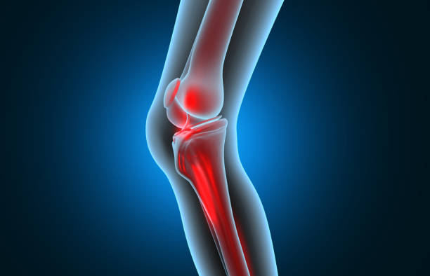 anatomía de la rodilla humana. dolor de rodilla - hueso fotografías e imágenes de stock
