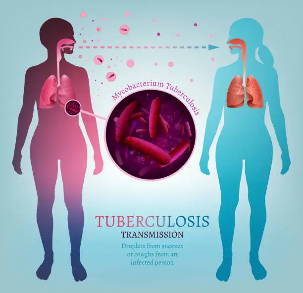 Vector illustration of Infectious disease transmission