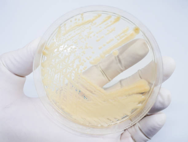 istock Yeast cultivation in medium agar plate for microbiology research laboratory 1250276355