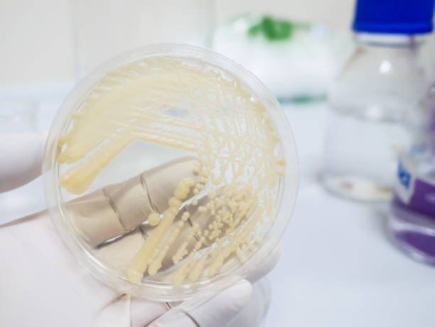 istock Yeast cultivation in medium agar plate for microbiology research laboratory 1250276358