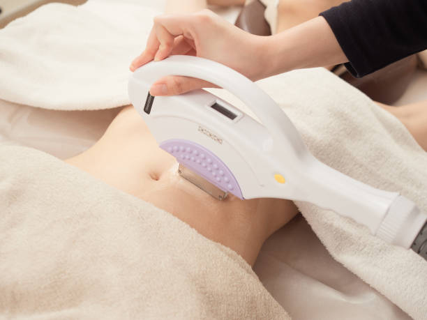 hair removal image - beauty spa flash imagens e fotografias de stock