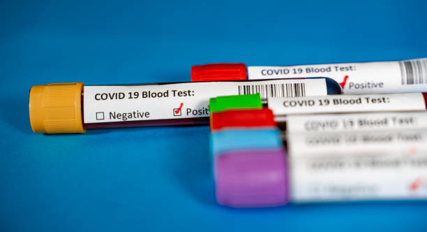 istock Corona virus Covid-19 novel corona virus concept 1250399186