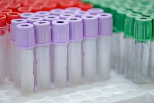 istock vacuum tubes for collecting blood samples in the lab 1250465988