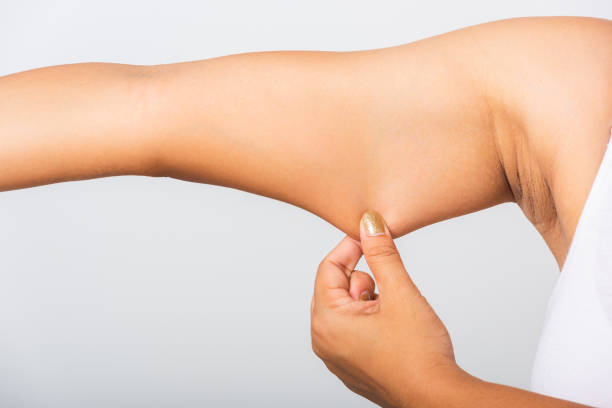 istock Close up of Asian woman pulling excess fat on her under arm, problem armpit skin, studio isolated on white background, Healthy overweight excess body concept 1250472747