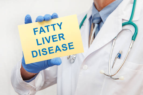 Doctor holding sign with text FATTY LIVER DISEASE closeup stock photo