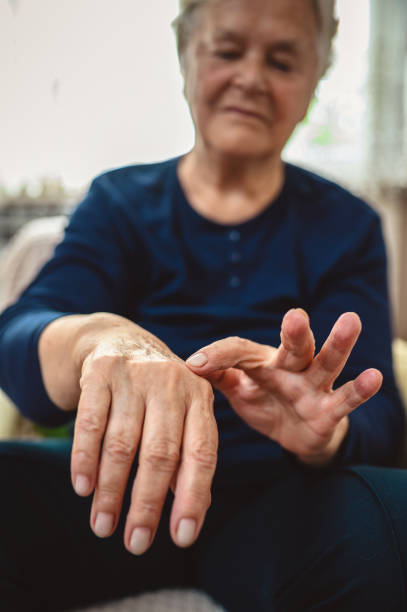 류머티즘으로 고통받는 손목과 팔을 문지르는 수석 여성 - arthritis senior adult rheumatoid arthritis sadness 뉴스 사진 이미지